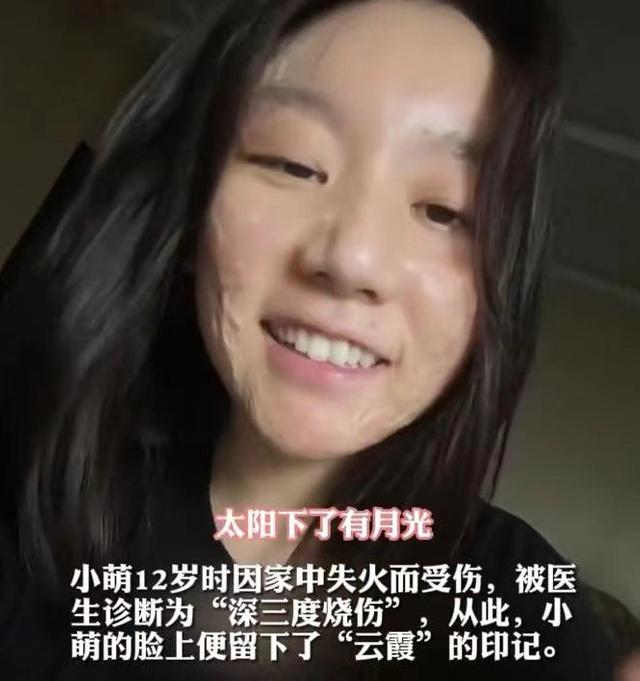 女主播大胆直播丰胸手术全过程，吸引11000人观看，揭露畸形审美