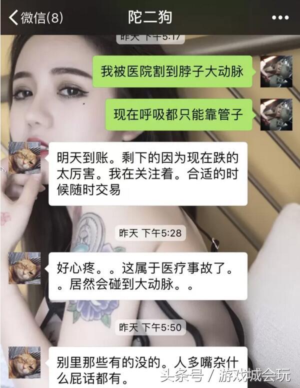 斗鱼美女主播因被吐槽脸大跑去整容削骨 不慎被割到动脉差点送命