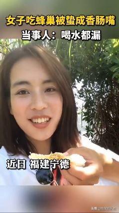 女主播户外直播吃蜂巢，下一秒直接变成“香肠嘴”