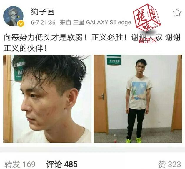 网红主播直播时被绑架，称被围殴签下3万元欠条