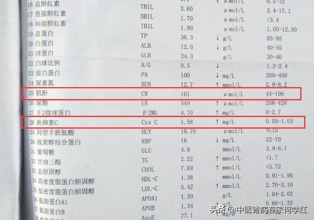 正常的肌酐上限是97还是133