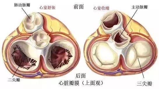 图文详解——心脏瓣膜：主动脉瓣、二尖瓣、肺动脉瓣、三尖瓣